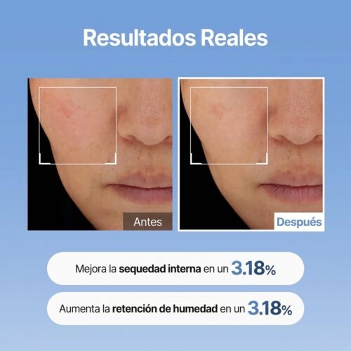 [Meditheraphy] Hyaluronic Acid Skin Booster First Serum 150ml - Imagen 5