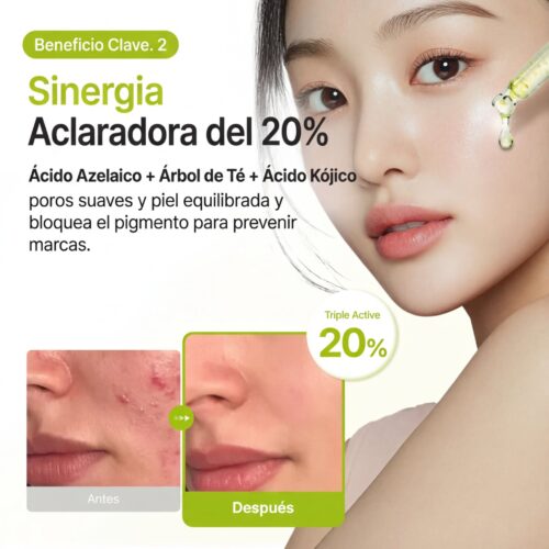 [Purito] Azelaic Acid 10 Kojic Tea Tree Serum 30ml - Imagen 4